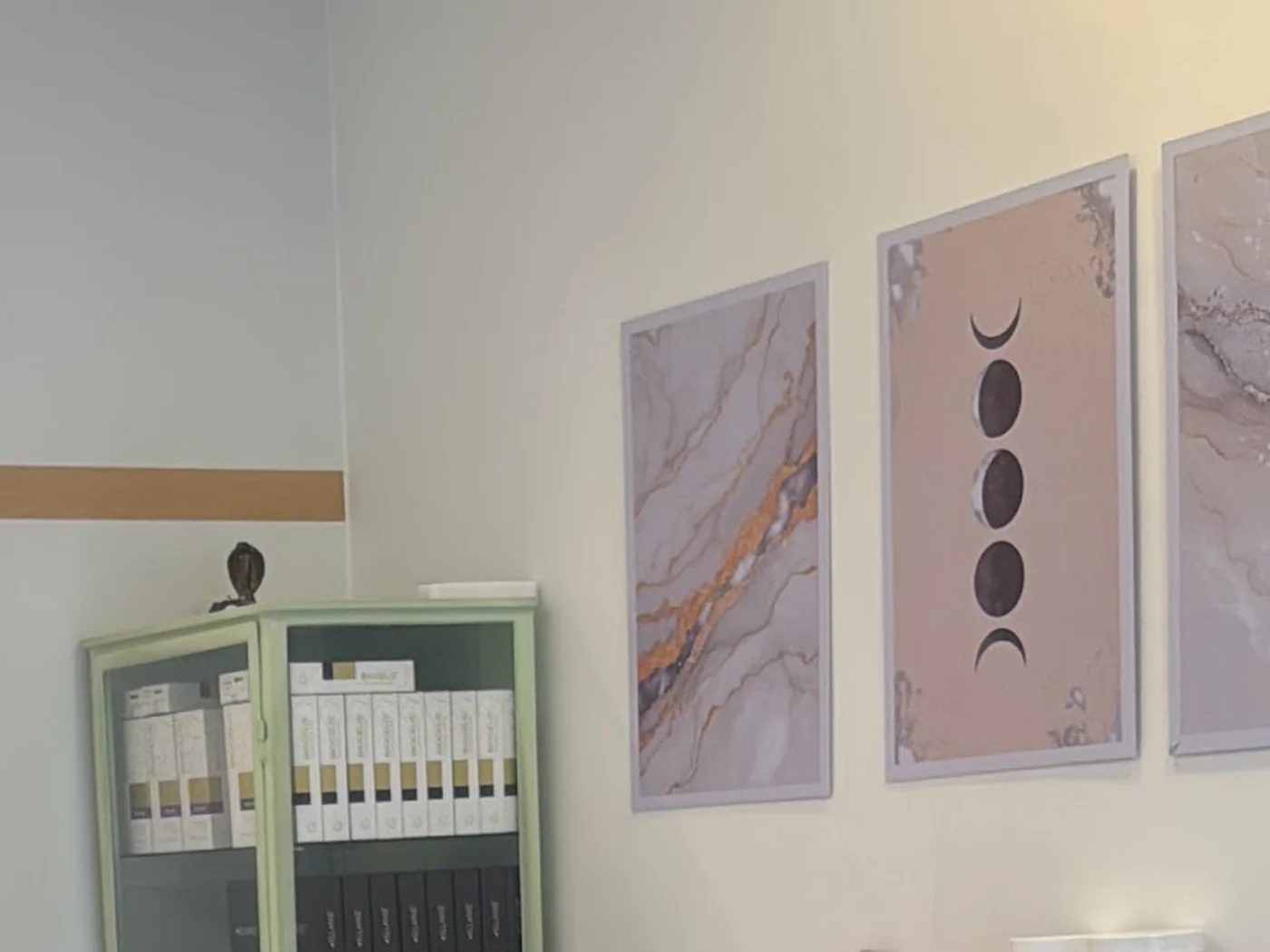 Sala de procedimento da Ellune Clinique, com os quadros das fases da lua na parede